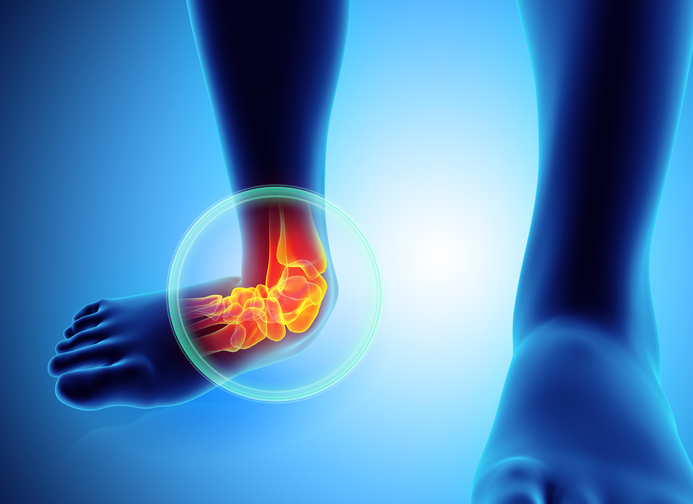 Treating Ankle Injuries Without Drugs